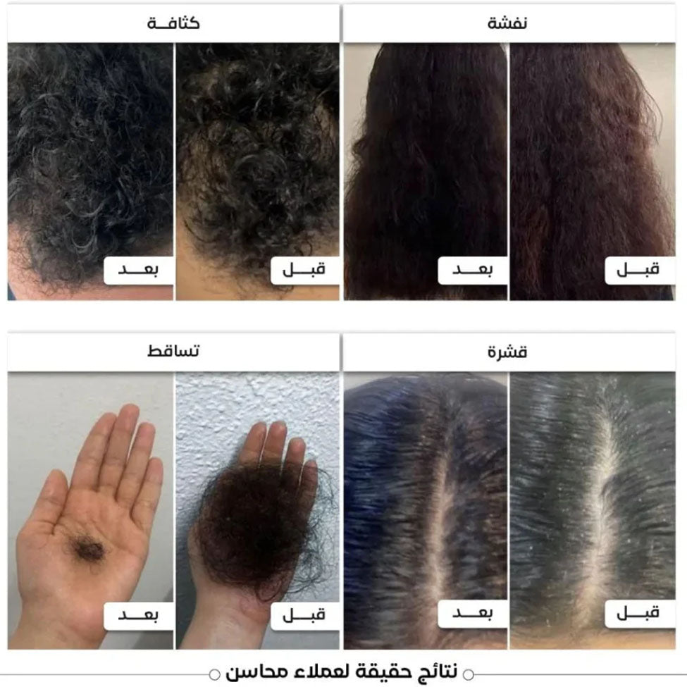 زيت محاسن الشعر 200 مل