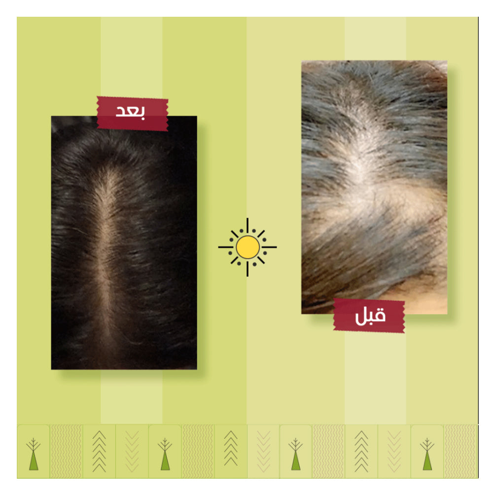 سبراي كارما تونيك اكسترا لعلاج تساقط الشعر 125 مل من اشري ناتشورال