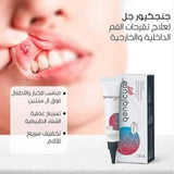 ديرما بيلا جنجكيور جل لعلاج تقرحات الفم 15 جرام